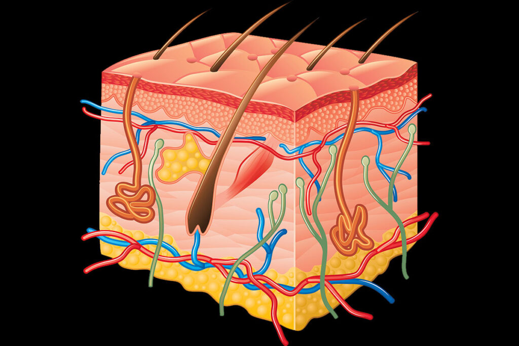 Complex Wounds With Systemic Diseases & General Conditions