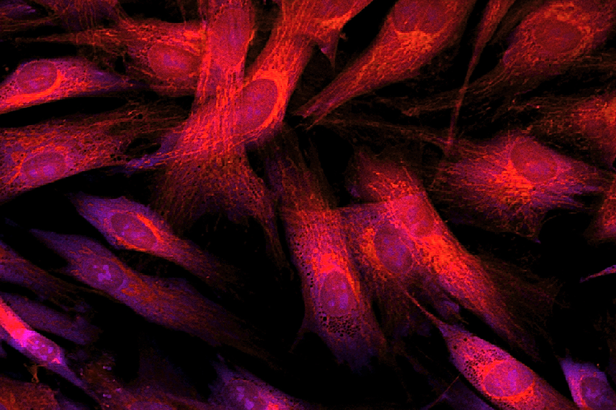 Imagery of chronic wounds in Los Angeles.