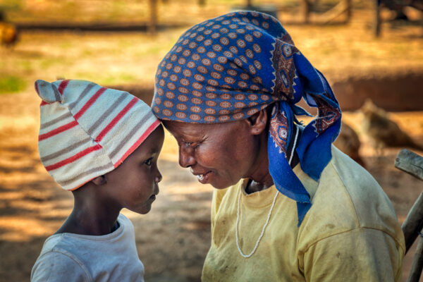 wound-burn-gh-2 wound-burn-gh-2